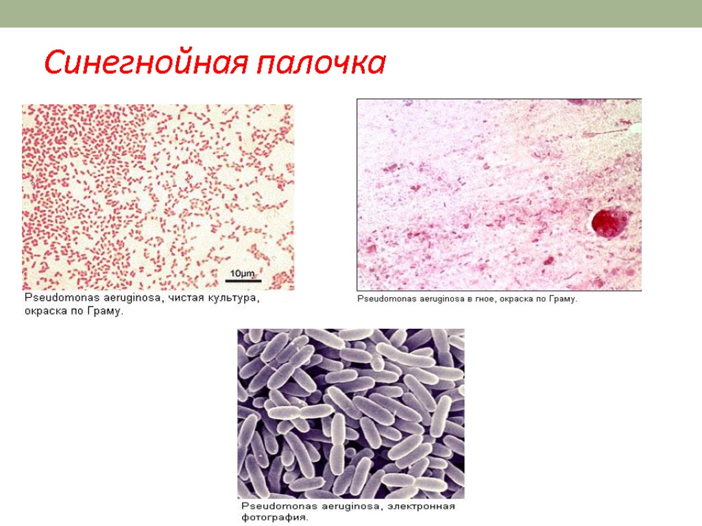 Синегнойная палочка